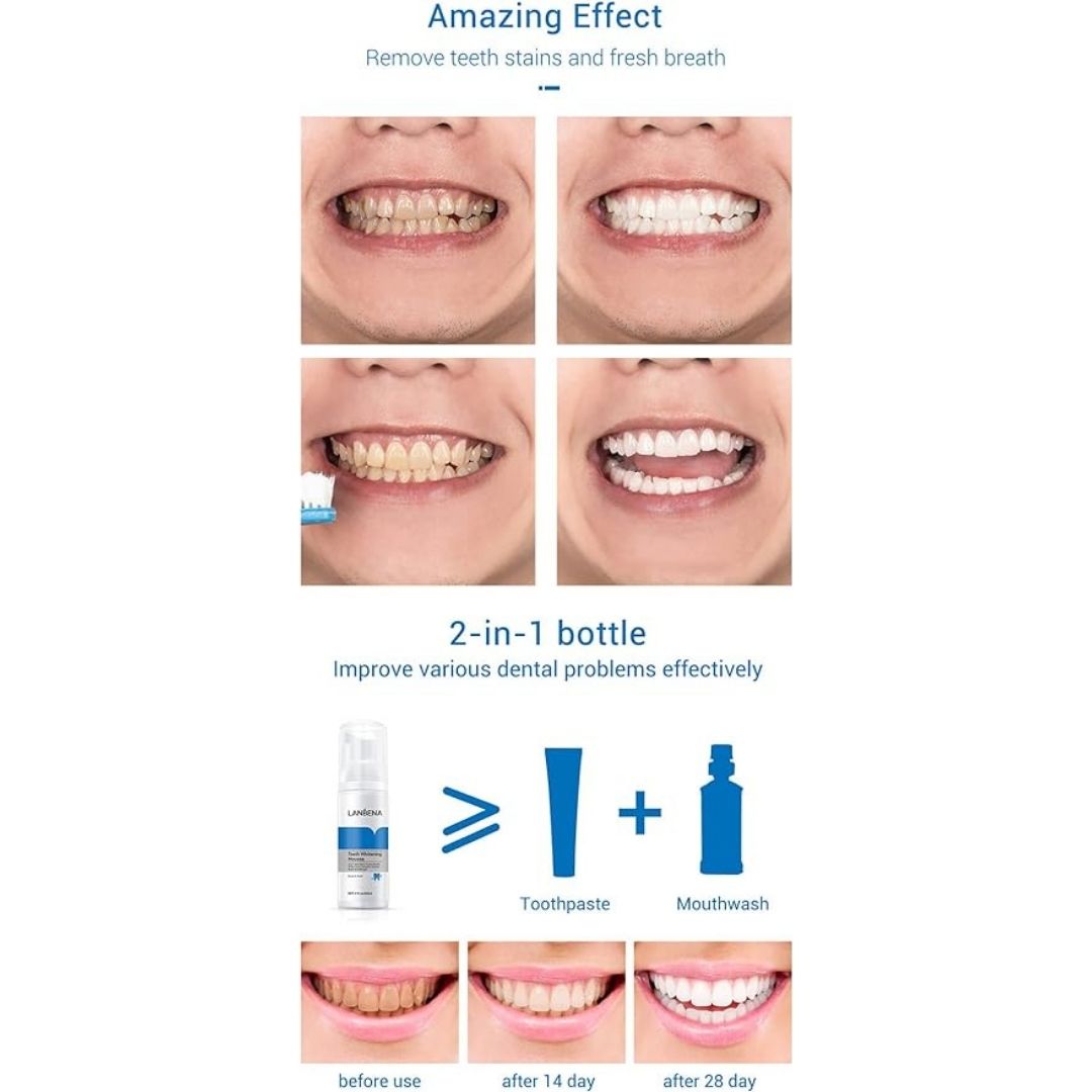 Teeth Whitening Mousse