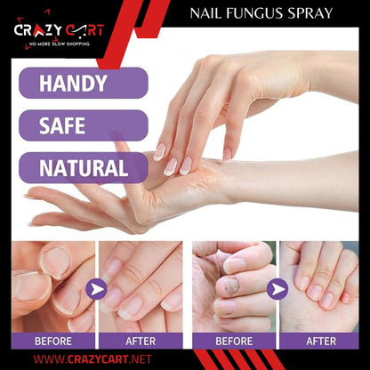 Nail Fungus Spray