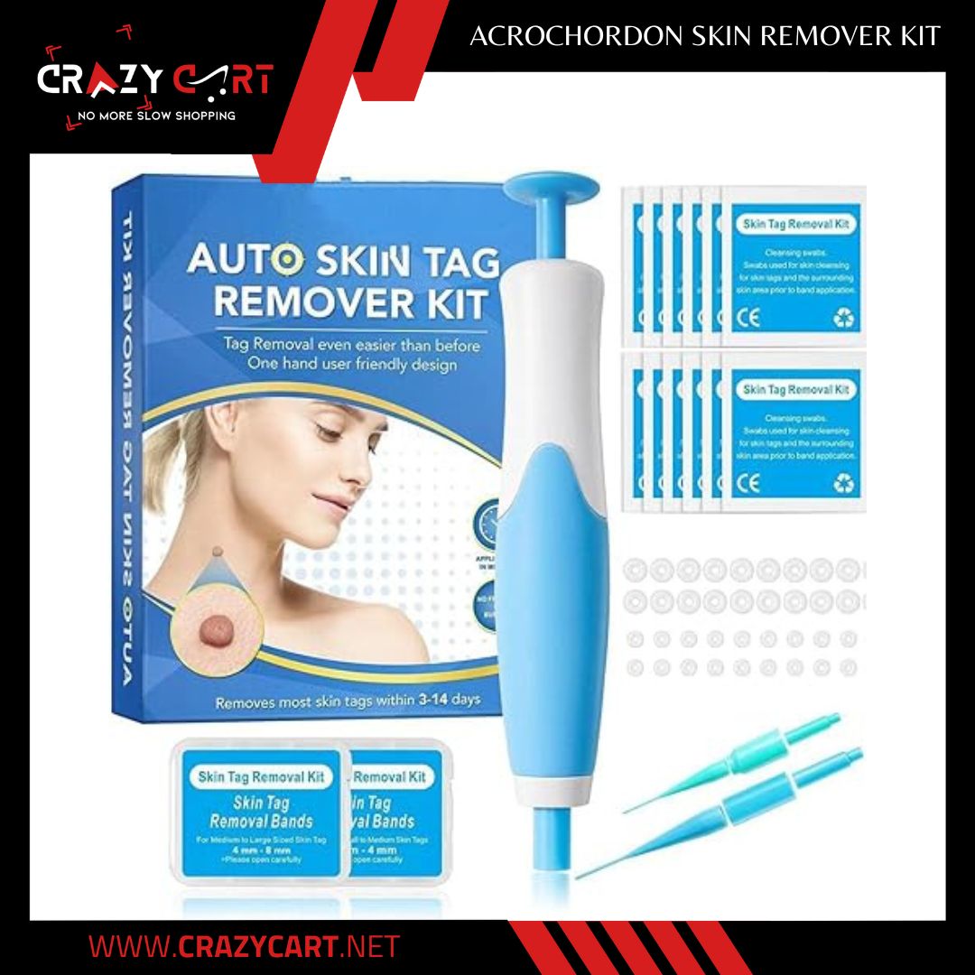 Acrochordon Skin Remover Kit
