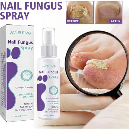 Nail Fungus Spray