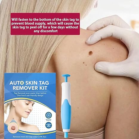 Acrochordon Skin Remover Kit