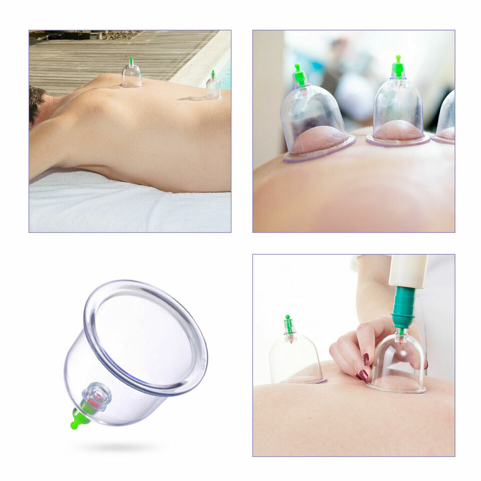 Body Cupping Healthy Set