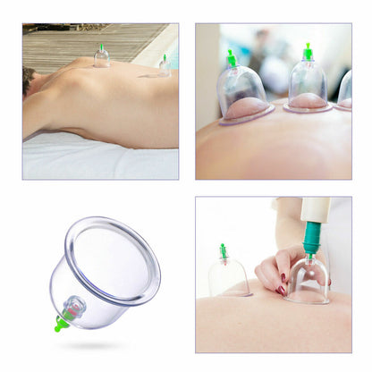 Body Cupping Healthy Set